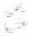 Fig. 06 - Dental covering removal tool