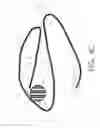 Fig. 07 - Orthodontic anchor system