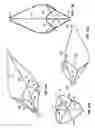 Fig. 07 - Tethered vena cava filter apparatus and method of using same