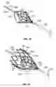 Fig. 13 - Tethered vena cava filter apparatus and method of using same