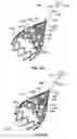 Fig. 15 - Tethered vena cava filter apparatus and method of using same