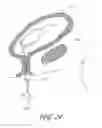 Fig. 31 - DELIVERY SYSTEM FOR INFLATABLE IMPLANT