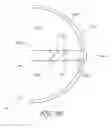 Fig. 55 - DELIVERY SYSTEM FOR INFLATABLE IMPLANT