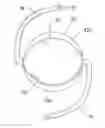 Fig. 01 - Intraocular lens and methods for implanting the same