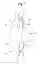 Fig. 06 - Intraocular lens and methods for implanting the same