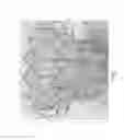 Fig. 02 - Replacement heart valve