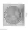 Fig. 03 - Replacement heart valve