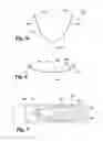 Fig. 05 - MITRAL PROLAPSE VALVE RESTRICTOR