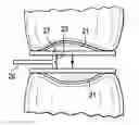 Fig. 01 - Patient-specific spinal fusion cage and methods of making same