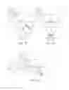 Fig. 07 - Vertebral implants and attachment assemblies