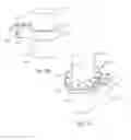 Fig. 13 - Vertebral implants and attachment assemblies