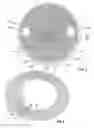 Fig. 04 - Load sustaining bone scaffolds for spinal fusion utilizing hyperbolic struts and translational strength gradients