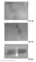 Fig. 06 - Load sustaining bone scaffolds for spinal fusion utilizing hyperbolic struts and translational strength gradients