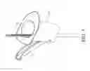 Fig. 04 - Bone graft delivery system and method for using same