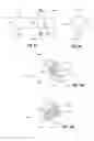 Fig. 09 - Systems for distracting uncinate joints