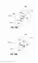 Fig. 17 - Systems for distracting uncinate joints