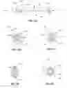 Fig. 10 - Medial to lateral uncinate joint stabilizer systems and methods