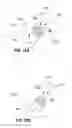 Fig. 11 - Medial to lateral uncinate joint stabilizer systems and methods