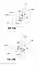 Fig. 17 - Medial to lateral uncinate joint stabilizer systems and methods