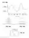 Fig. 17 - ELECTRONICALLY CONTROLLED PROSTHETIC SYSTEM
