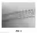 Fig. 03 - Bidirectional stent and method of use thereof