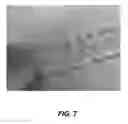 Fig. 07 - Bidirectional stent and method of use thereof
