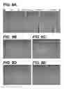 Fig. 08 - Bidirectional stent and method of use thereof