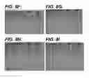 Fig. 09 - Bidirectional stent and method of use thereof