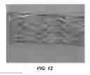 Fig. 12 - Bidirectional stent and method of use thereof