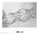 Fig. 15 - Bidirectional stent and method of use thereof