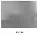 Fig. 17 - Bidirectional stent and method of use thereof