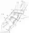 Fig. 01 - MOLDABLE WRIST BRACE
