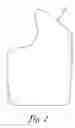 Fig. 03 - MOLDABLE WRIST BRACE