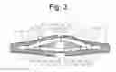 Fig. 04 - WAIST BELT