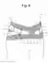 Fig. 07 - WAIST BELT