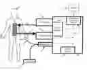 Fig. 01 - Method and system to detect changes in a patients's endogenous temperature set-point during externally induced targeted temperature management