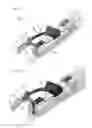 Fig. 03 - Implant delivery devices, systems, and methods