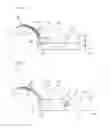 Fig. 05 - Implant delivery devices, systems, and methods