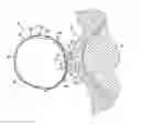 Fig. 01 - INSTRUMENTS FOR REMOVING DEBRIS FROM AN EYE