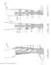 Fig. 14 - Functional sock