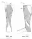 Fig. 20 - Functional sock