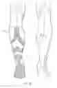 Fig. 26 - Functional sock