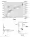 Fig. 11 - DEVICES, SYSTEMS AND METHODS FOR SENSING THE WELL-BEING OF A SUBJECT