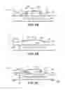 Fig. 09 - Absorbent article with partially separable, skin-contacting topsheet layer