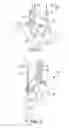 Fig. 03 - Ceiling lift tilt management system