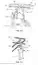 Fig. 05 - Tiltable patient ceiling lift assembly