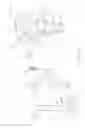 Fig. 05 - Pinless loading for spine table