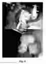 Fig. 06 - PSMA-targeting imaging agents