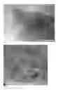 Fig. 02 - Amorphous carbon supported nanoparticles comprising oxides of lanthanides and method for preparing them