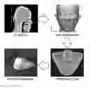 Fig. 01 - Multi-layer skin substitute products and methods of making and using the same